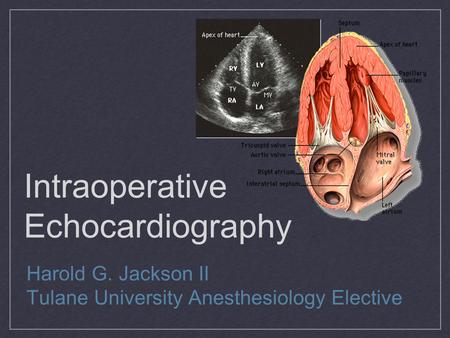 Intraoperative Echocardiography Harold G. Jackson II Tulane University Anesthesiology Elective.