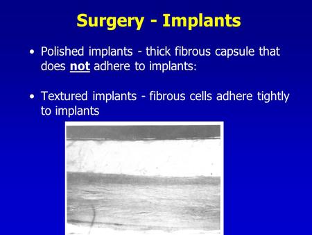 Surgery - Implants Polished implants - thick fibrous capsule that does not adhere to implants : Textured implants - fibrous cells adhere tightly to implants.