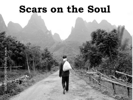 Scars on the Soul www.kevinhinckley.com. Basic Truth…. Your perception becomes your reality. Your personal history Is based on How you interpreted.