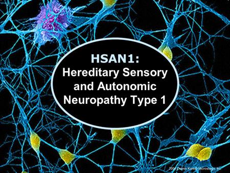 HSAN1: Hereditary Sensory and Autonomic Neuropathy Type 1 2004 Dennis Kunkel Microscopy, Inc.