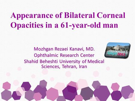 Mozhgan Rezaei Kanavi, MD. Ophthalmic Research Center Shahid Beheshti University of Medical Sciences, Tehran, Iran Appearance of Bilateral Corneal Opacities.