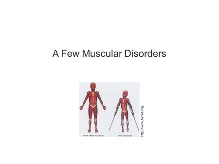 A Few Muscular Disorders  2 Much of the text material is from, “Principles of Anatomy and Physiology, 14th edition” by Gerald J.