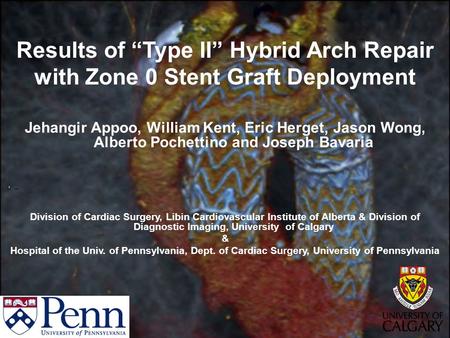 Results of “Type II” Hybrid Arch Repair with Zone 0 Stent Graft Deployment Jehangir Appoo, William Kent, Eric Herget, Jason Wong, Alberto Pochettino and.