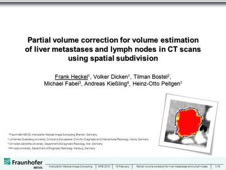 15 February Partial volume correction for liver metastases and lymph nodes1Institute for Medical Image Computing/16SPIE 2010 Partial volume correction.
