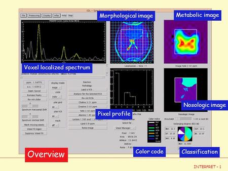 INTERPRET - 1 Voxel localized spectrum Metabolic image Morphological image Pixel profile Nosologic image Classification Color code Overview.