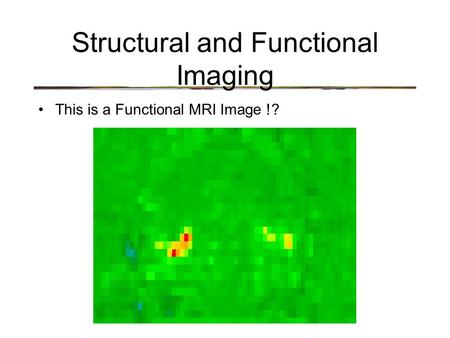 Structural and Functional Imaging This is a Functional MRI Image !?
