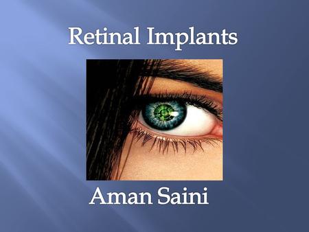  Retinitis Pigmentosa Tunnel Vision due to degeneration of retinal photoreceptors.