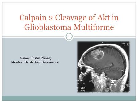 Calpain 2 Cleavage of Akt in Glioblastoma Multiforme Name: Justin Zhang Mentor: Dr. Jeffrey Greenwood.