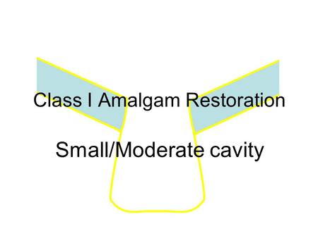 Class I Amalgam Restoration