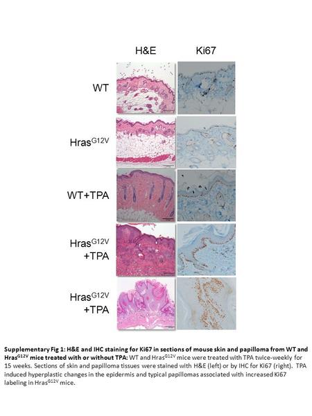 WT Hras G12V WT+TPA Hras G12V +TPA Hras G12V +TPA H&EKi67 Supplementary Fig 1: H&E and IHC staining for Ki67 in sections of mouse skin and papilloma from.