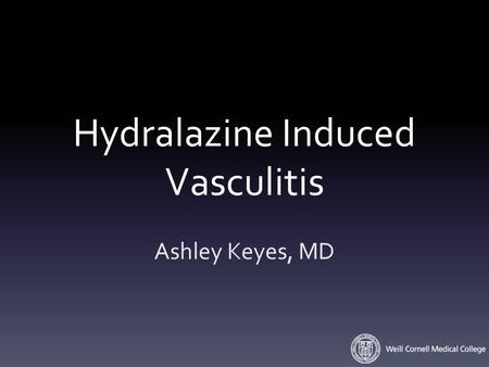 Hydralazine Induced Vasculitis