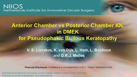 V. S. Liarakos, K. van Dijk, L. Ham, L. Baydoun and G.R.J. Melles Anterior Chamber vs Posterior Chamber IOL in DMEK for Pseudophakic Bullous Keratopathy.