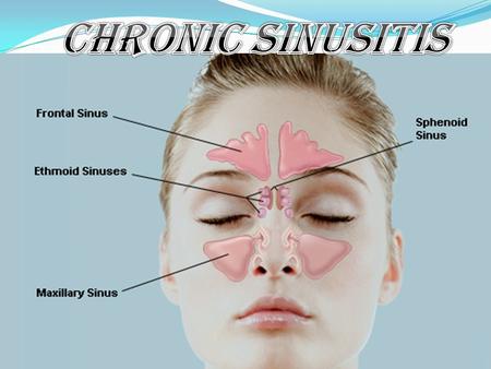 Chronic Sinusitis.