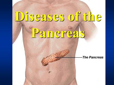 Diseases of the Pancreas. 67 y old male with loss of appetite, gradual weight loss and dyspepsia. Recent onset of jaundice and dark urine.