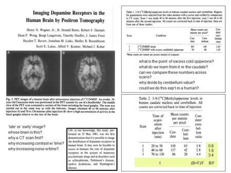 T (B+F)/F B/F 0.8 1.8 3.4 ‘late’ or ‘early’ image? whose brain is this? why a CT scan first? why increasing contrast w/ time? why increasing noise w/time?