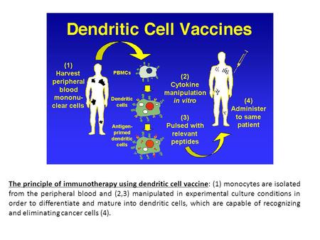 The principle of immunotherapy using dendritic cell vaccine: (1) monocytes are isolated from the peripheral blood and (2,3) manipulated in experimental.