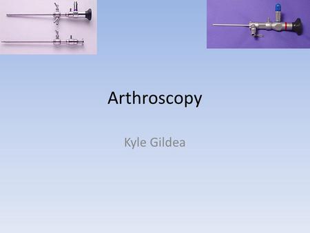 Arthroscopy Kyle Gildea. What is Arthroscopy? Non Invasive procedure Used to repair joint injuries Uses medical tool called Arthroscope Is done 600,000.