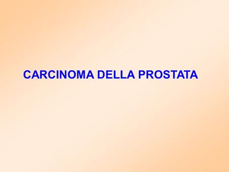 CARCINOMA DELLA PROSTATA. PROSTATE CANCER Prostate Anatomy.
