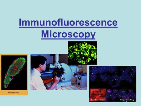 Immunofluorescence Microscopy. Immunofluorescence Microscopy: When an antibody, or the antiimmunoglobulin antibody used to detect the antibody is labeled.