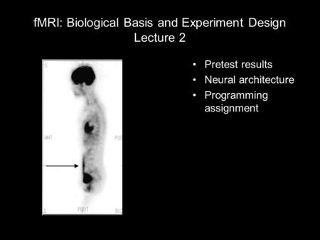FMRI: Biological Basis and Experiment Design Lecture 2 Pretest results Neural architecture Programming assignment.