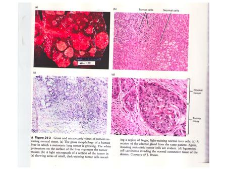 Figure 11.14a The Biology of Cancer (© Garland Science 2007) Excise cancer from Breast Isolate Cancer cells No Tumor Inject mice 10 3 cells 10 4 cells.