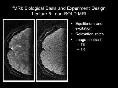 FMRI: Biological Basis and Experiment Design Lecture 5: non-BOLD MRI Equilibrium and excitation Relaxation rates Image contrast –TE –TR.