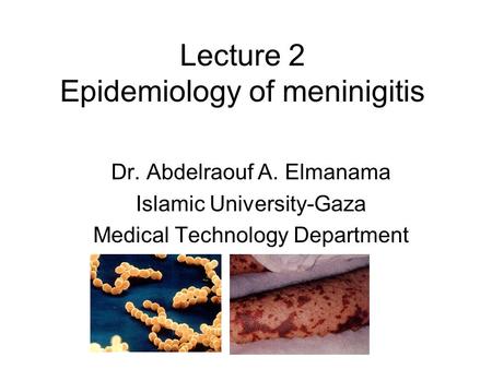 Lecture 2 Epidemiology of meninigitis