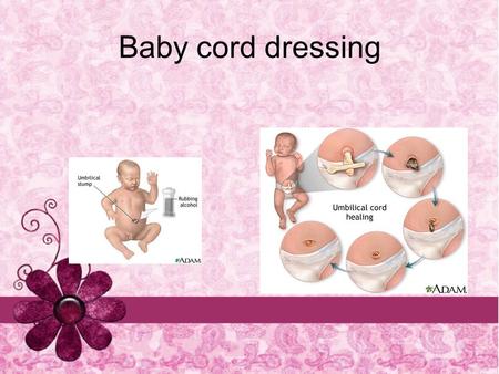Baby cord dressing. Definition: It is the technique by which the umbilical cord of the newborn infant is weaned. It aims at proper and complete healing.