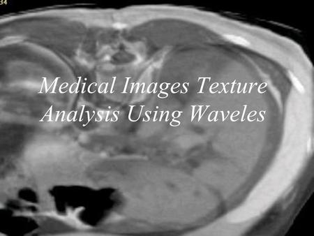 Medical Images Texture Analysis Using Waveles. Why Texture Analysis? Method for differentiation between normal and abnormal tissue. Contrast between malignant.