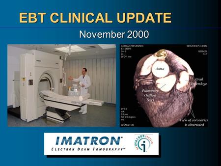 EBT CLINICAL UPDATE November 2000. EBT Clinical Applications CARDIAC IMAGING Coronary Artery Calcium Scanning Coronary Electron Beam Angiography (EBA)