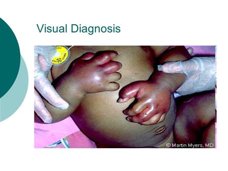 Visual Diagnosis. A Hypoxic Teen Inpatient Eva Delgado, MD Morning Report.