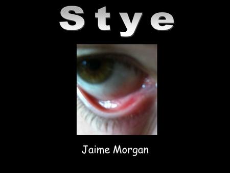 Stye Jaime Morgan.