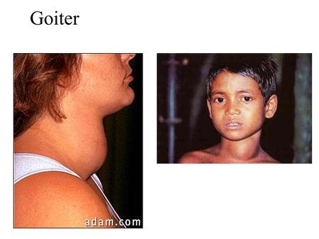 Goiter. Thyroid Gland Thyroid Hormones: Functions PERMISSIVE ACTIONS –Growth and development –Reproduction DIRECT EFFECTS –Metabolic/thermogenic.