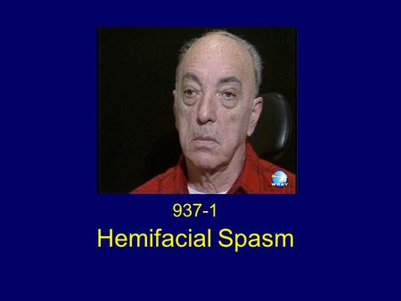 Hemifacial Spasm 937-1. Hemifacial Spasm Characterized by: Paroxysmal, involuntary clonic and tonic synchronous contraction of the muscles innervated.