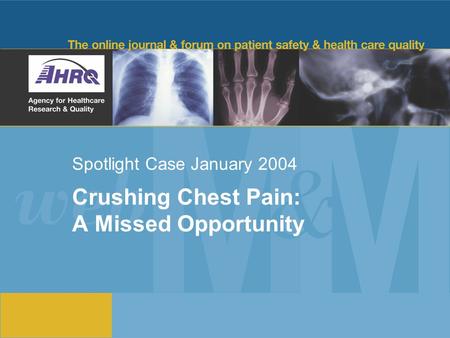 Spotlight Case January 2004 Crushing Chest Pain: A Missed Opportunity.