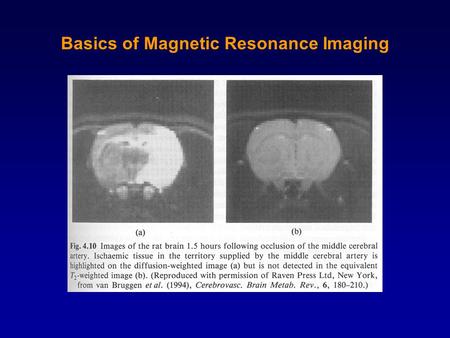 Basics of Magnetic Resonance Imaging