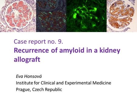 Case report no. 9. Recurrence of amyloid in a kidney allograft Eva Honsová Institute for Clinical and Experimental Medicine Prague, Czech Republic.