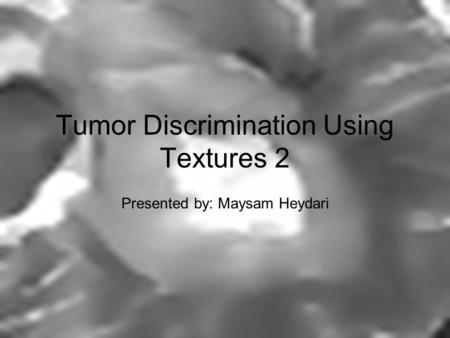 Tumor Discrimination Using Textures 2 Presented by: Maysam Heydari.