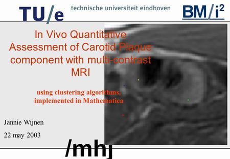 /mhj In Vivo Quantitative Assessment of Carotid Plaque component with multi-contrast MRI Jannie Wijnen 22 may 2003 using clustering algorithms, implemented.