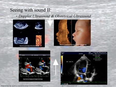 - Doppler Ultrasound & Obstetrical Ultrasound