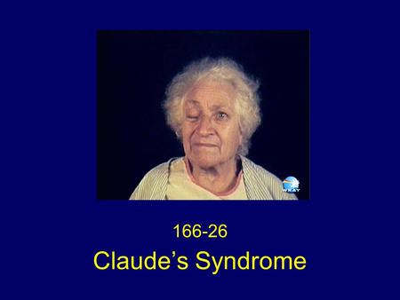 166-26 Claude’s Syndrome.