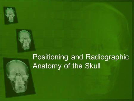 Positioning and Radiographic Anatomy of the Skull