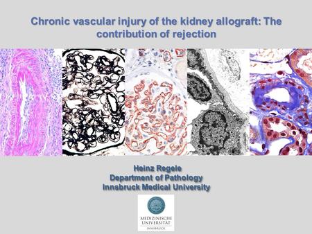 Chronic vascular injury of the kidney allograft: The contribution of rejection Heinz Regele Heinz Regele Department of Pathology Innsbruck Medical University.