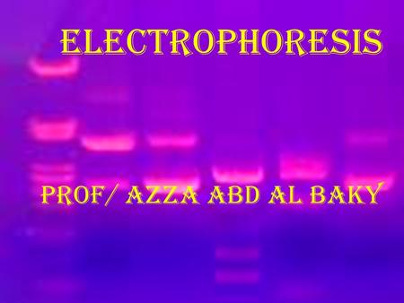 ELECTROPHORESIS Prof/ Azza abd al baky.