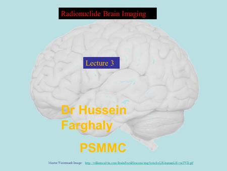 Dr Hussein Farghaly PSMMC Radionuclide Brain Imaging Lecture 3