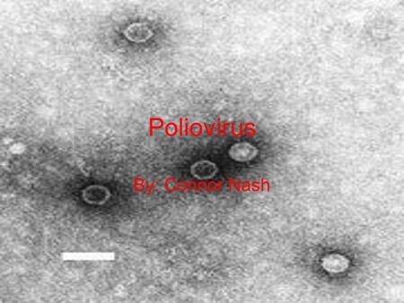 Poliovirus By: Connor Nash.