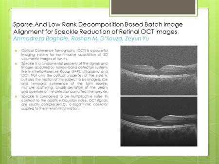 Sparse And Low Rank Decomposition Based Batch Image Alignment for Speckle Reduction of Retinal OCT Images Ahmadreza Baghaie, Roshan M. D’Souza, Zeyun Yu.