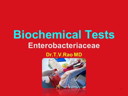 Biochemical Tests Enterobacteriaceae