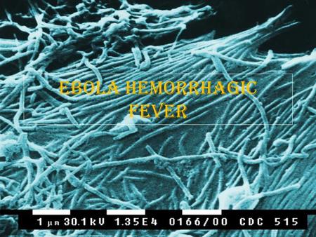 Ebola Hemorrhagic Fever. Viral Overview