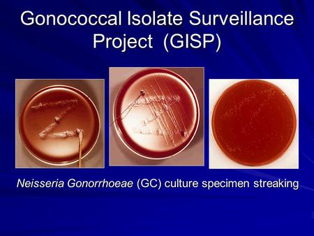 Gonococcal Isolate Surveillance Project (GISP)